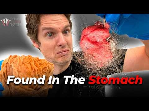 5 Shocking Things People Swallow (And What Happens)