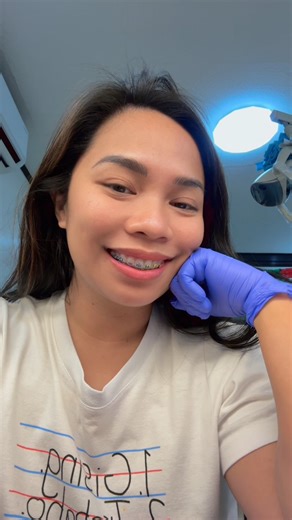 DIY BRACES YARN? 😬😭 | Ella Roxas