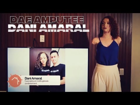 THE STORY OF DANI AMARAL A WOMAN WITH A DOUBLE ARM AMPUTATION 