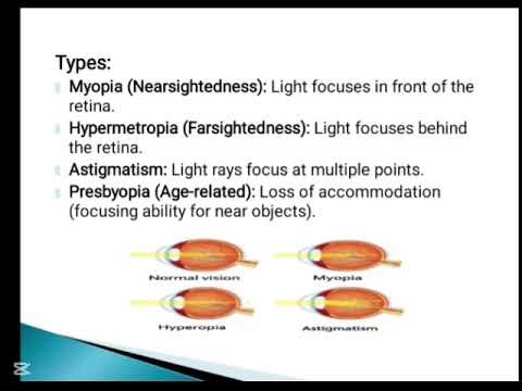 Refractive Error Lecture hindi/Urdu