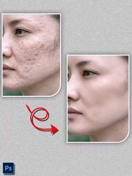 How to Skin Retouch Using Frequency Separation in Adobe Photoshop Like a Pro | Portrait Retouching