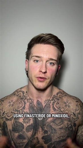 Achieve Hair Growth with Finasteride and Minoxidil