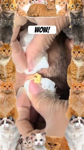 Blackheads Removal | Acne Treatment and Very Satisfying Satisfying Pimple pop #blackheads