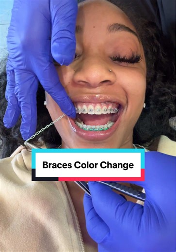 Come with me to get my braces color changed #braces #orthodontistsoftiktok #orthodontists #dentistappointment #bracescolors