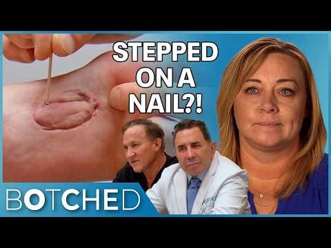 Lita Stepped On A NAIL and It Caused A Lifelong Painful Growth Under Her Foot | Botched | E!