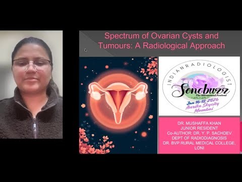 Mushaffa Khan : Spectrum of Ovarian cysts & Tumors: Radiological Approach #sonobuzz