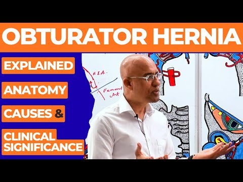 Obturator Hernia Explained | Anatomy, Causes & Clinical Significance