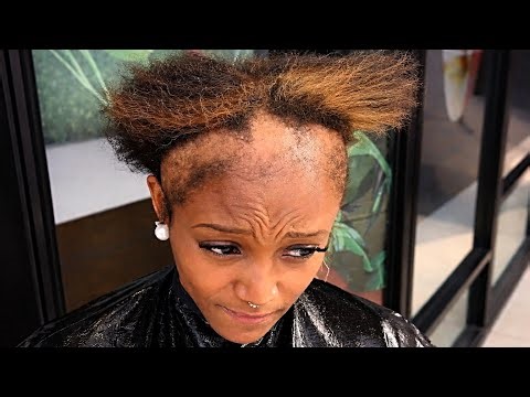 She Just Wanted to go Back to the Past & Embrace Her Natural Hair | Severe Hair Loss