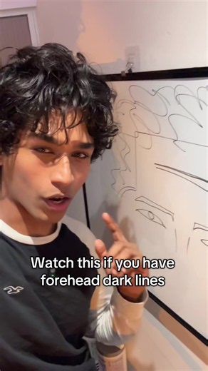 How to Get Rid of Forehead Dark Lines and Wrinkles