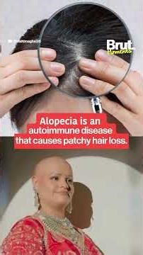 “I look beautiful without hair...” This bride embraced alopecia and walked the aisle with confidence