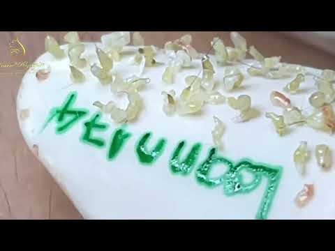 Loan Nguyen Acne Treatment 46qq