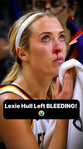 Lexie Hull Took a HUGE Hit! 😬 #caitlinclark #basketball