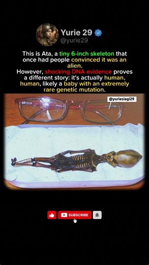 The "Alien" Skeleton That Fooled the World: The Bone-Chilling Truth 👽🦴