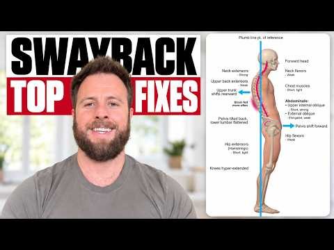 Swayback Posture Correction | 5 POWERFUL Exercises