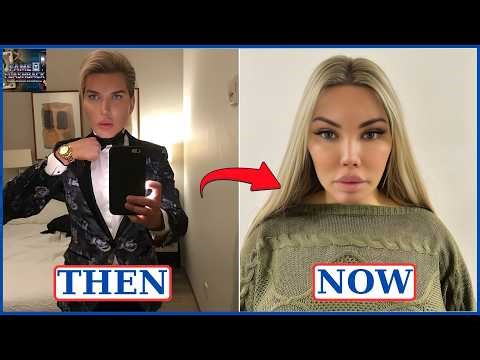 10 Celebrity Plastic Surgery Transformations | Then vs Now 2026