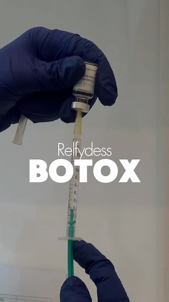 Relfydess ist ein innovatives Botulinumtoxin, das dank seiner speziellen Formulierung bereits nach 24 Stunden erste Effekte zeigt und bis zu sechs Monate wirkt. Die gebrauchsfertige Lösung ermöglicht eine präzisere Anwendung und konstante Ergebnisse, wodurch weniger Behandlungstermine erforderlich sind. #infinitglow #infinitglowmed #infinitglowberlin #skin #skincare #skinlove #dermatology #botox #filler #health #biofiller #aesthetic