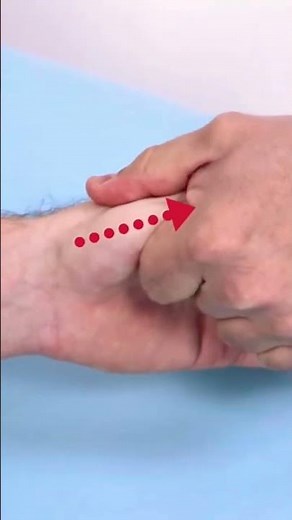 Traction Shift Subluxation Relocation Test | CMC 1 Osteoarthritis #shorts