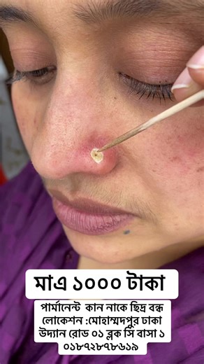 #1millionaudition #টিকটক_বাংলাদেশ_অফিসিয়াল🇧🇩🇧🇩🇧🇩 #বাংলাদেশি_ভাইরাল_টিকটক_ #foryoupage @White House Beauty Parlour 3 @Aesthetic Skin Care