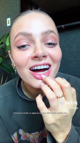 Teeth Whitening Transformation with V34 Strips