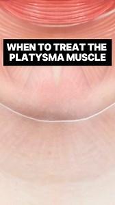 10K views · 75 reactions | The platysma isn’t just a neck muscle. It...