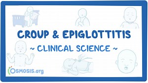 Croup and epiglottitis: Video & Meaning | Osmosis