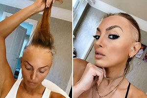 Model with alopecia like Jada Pinkett Smith says it can highly impact mental health