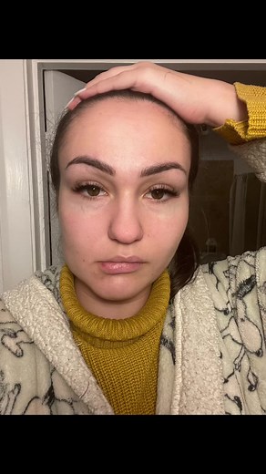 Coronectomy Procedure Explained