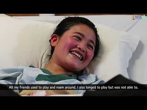 Clubfoot Treatment & Surgery | Clubfoot Deformity Correction - Max Hospital