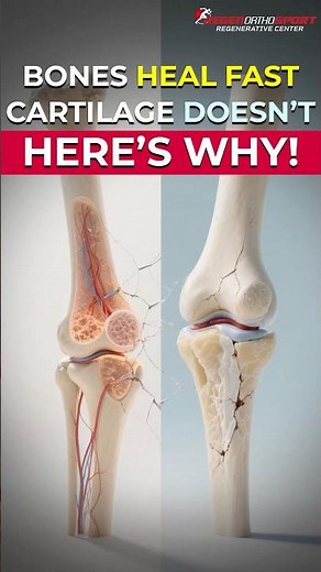 PRP or Stem Cells? The Right Fix for Tendons vs Cartilage