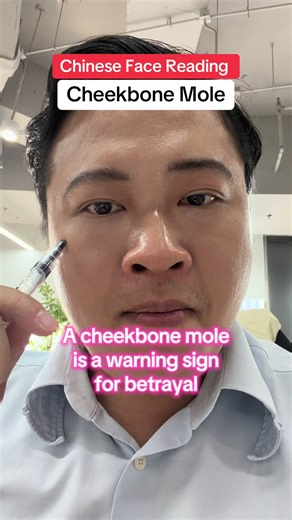 cheekbones represent your social standing and authority. A mole here—especially a dull or dark one—can signal a