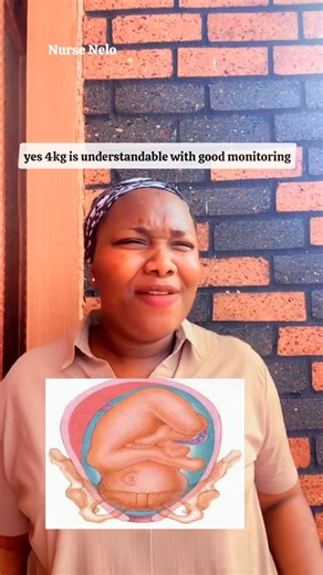 Obstructed Labor can be Avoided if only Pregnant Women would Listen!! | Nurse Nelo Consults