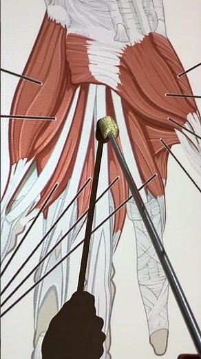 Lumbricals of the hand #anatomy #anatomy #anatomystudy #biomechanics