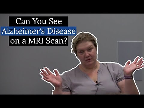Can You See Alzheimer's Disease on a MRI?