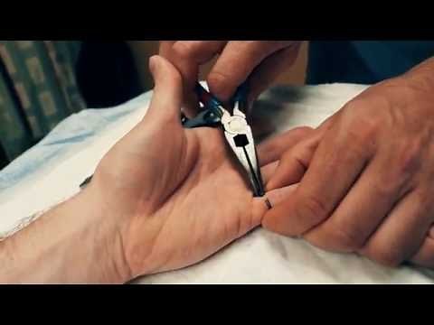 Ring Removal with Raptor Trauma Shears