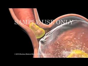 Enfermedades del a. Digestivo