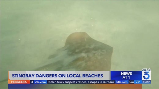 Popular SoCal beach seeing a surge of stingray injuries