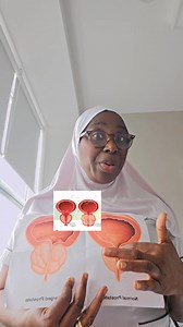 38K views · 1K reactions | Enlarge and Cancer of prostate. Our youths are misplacing their priority | Couples Connect Network By Sister Mariam Balogun | Facebook