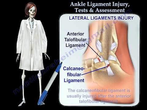 Ankle Ligament Injury Tests & Assessment - Everything You Need To Know - Dr. Nabil Ebraheim