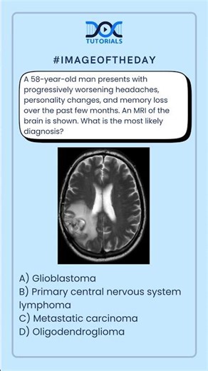 What is the most likely diagnosis?