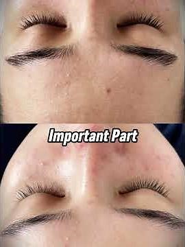 Deep Cleanse Routine That Clears Every Pore! 🌿 | Dr. Sandra Lee