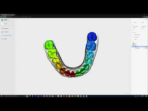 3D Teeth Segmentation with AI | Imagoworks Technology