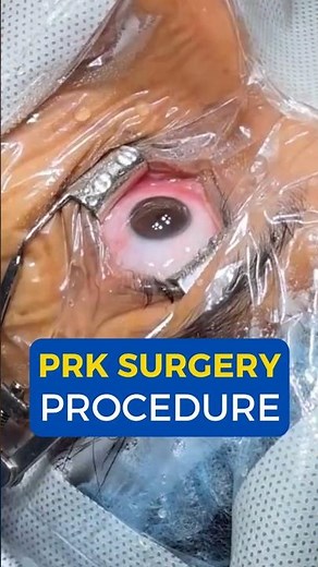 What is PRK Surgery I PRK Surgery Procedure