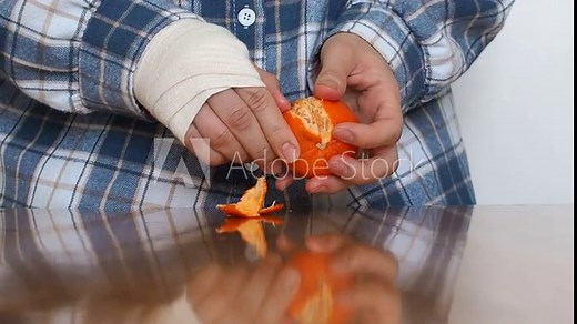 Female hand wrapped in elastic bandage typing on a laptop computer keyboard. Manager with one broken wrist works the Internet at home.
