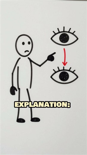 Alice in Wonderland Syndrome Explained: Why Your Hand Looks Huge