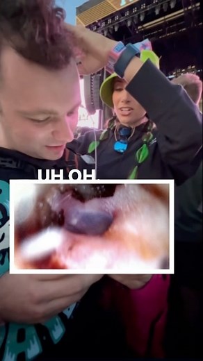 The dirty ear challenge!!! Look inside their ears with me and see who has the dirtiest ears! Winner gets a medal 🏅 Did you agree with the outcome?! I am using the Scope Around camera (found in the link in my bio) to look in festival attendees’ ears and we had a blast!! People were so excited to see what their wax situation was! I think all households should have a video otoscope on hand so you don’t have to guess if you have wax or not 😜 #scopearound #videootoscopy #videootoscope #audiology #a