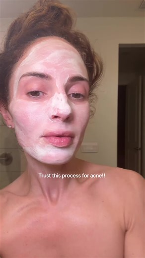 Effective Sulfur Treatments for Acne-Prone Skin