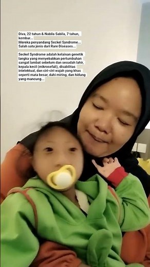 #SeckelSyndrome #RareDiseases