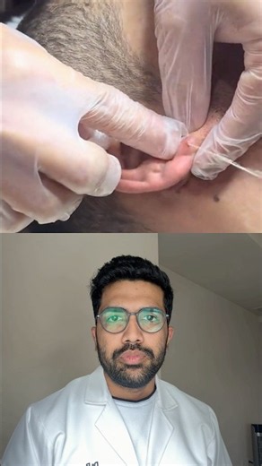 Watch it till the end for a BIG surprise