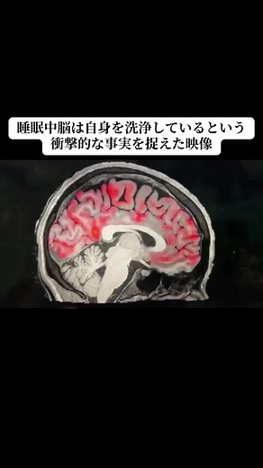 睡眠中の脳の洗浄プロセスを解説