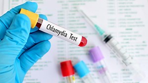 How Does Chlamydia Affect Men? Expert Shares Symptoms, Risk Factors, And Treatment